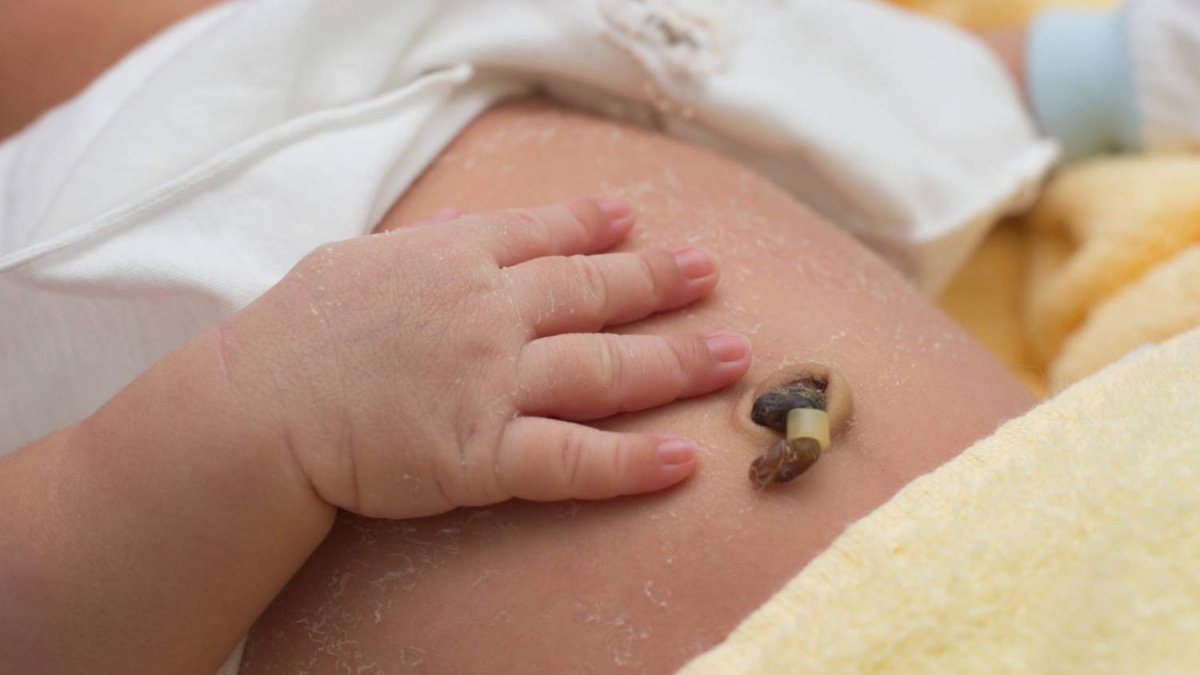 Araştırma: Göbek kordonu kanı doğumdan itibaren Tip 1 diyabet riskini gösterebilir