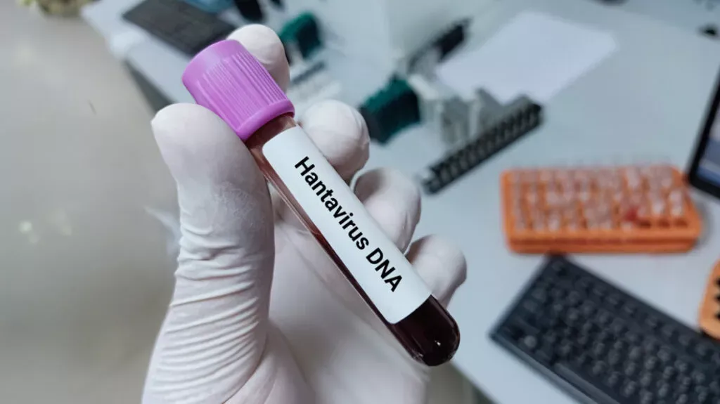 Bilim insanları, kruvaziyer gemisinde başlayan Andes hantavirüs salgınını izliyor; küresel temas takibi genişliyor