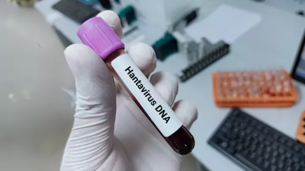 Bilim insanları, kruvaziyer gemisinde başlayan Andes hantavirüs salgınını izliyor; küresel temas takibi genişliyor