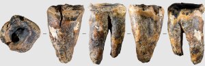 Sibirya mağarasında bulunan diş, Neandertal diş cerrahisini ortaya koydu