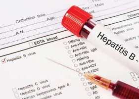 Kıbrıs'ta Viral Hepatit Ölümleri AB Ortalamasının Altında
