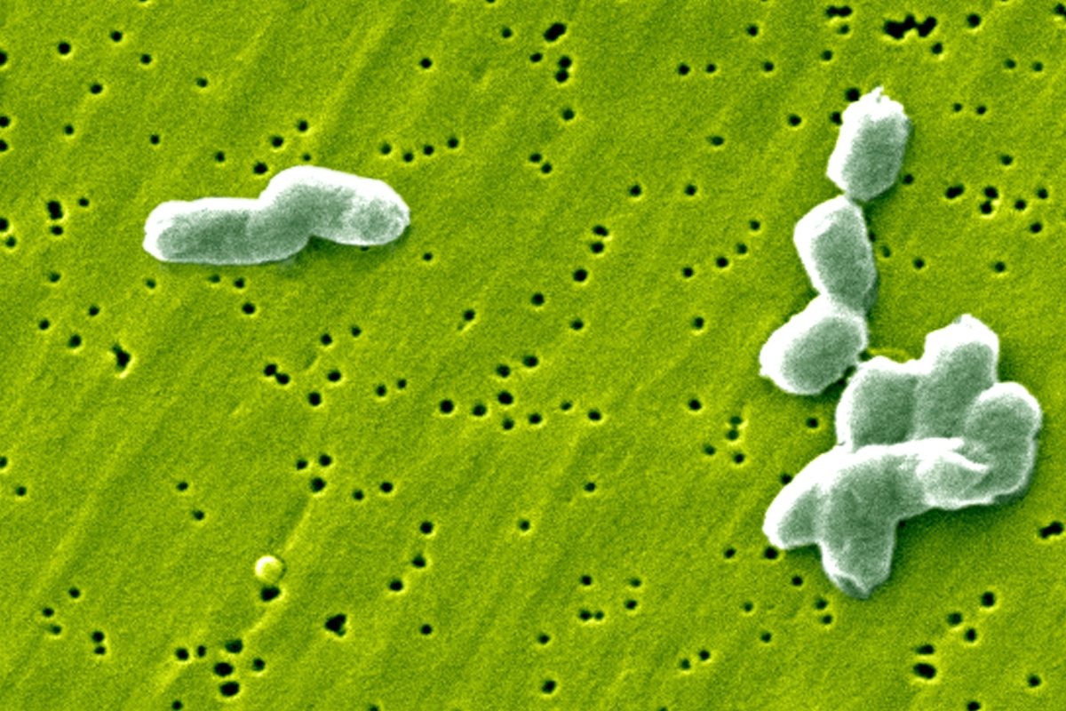 Belçika'da Rekor Salmonella Salgını: En Az 306 Kişi Etkilendi