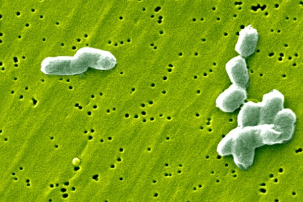 Belçika'da Rekor Salmonella Salgını: En Az 306 Kişi Etkilendi