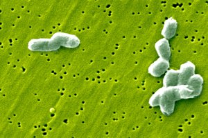 Belçika'da Rekor Salmonella Salgını: En Az 306 Kişi Etkilendi